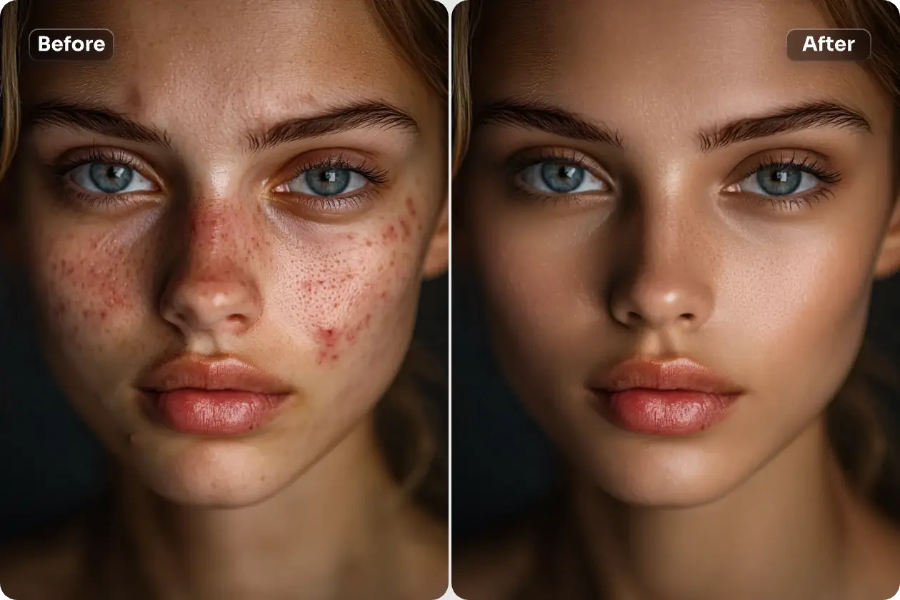 Skin Retouch banner showing example of acne removal and skin smoothing